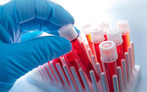 تصویر برای دسته  هماتولوژی