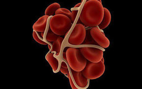 تصویر برای دسته  کوآگلومترها